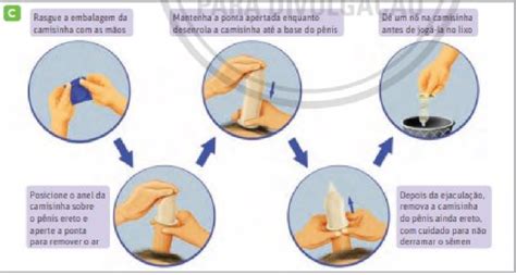 Camisinha: passo a passo para usar o preservativo。